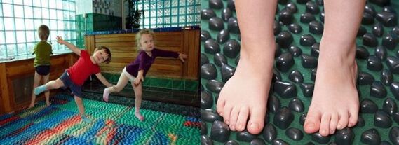 Gymnastik für Valgus -Deformation